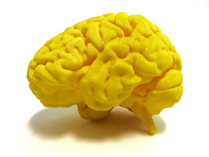 3D model of a human brain. Credit: Nevit Dilmen, NIH 3D Print Exchange, National Institute of Health